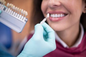 The Benefits of Dental Implants in Adelaide